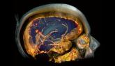 Cerveau humain, scanner en 3D